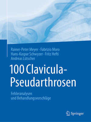 Buchcover 100 Clavicula-Pseudarthrosen | Rainer-Peter Meyer | EAN 9783662553442 | ISBN 3-662-55344-9 | ISBN 978-3-662-55344-2