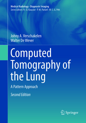 Buchcover Computed Tomography of the Lung | Johny A. Verschakelen | EAN 9783662568637 | ISBN 3-662-56863-2 | ISBN 978-3-662-56863-7