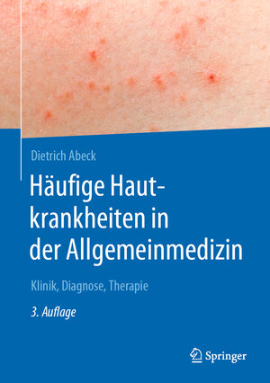 Buchcover Häufige Hautkrankheiten in der Allgemeinmedizin | Dietrich Abeck | EAN 9783662574478 | ISBN 3-662-57447-0 | ISBN 978-3-662-57447-8