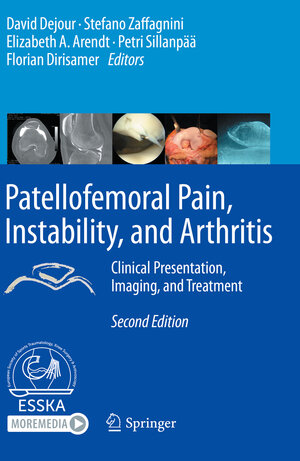 Buchcover Patellofemoral Pain, Instability, and Arthritis  | EAN 9783662610992 | ISBN 3-662-61099-X | ISBN 978-3-662-61099-2