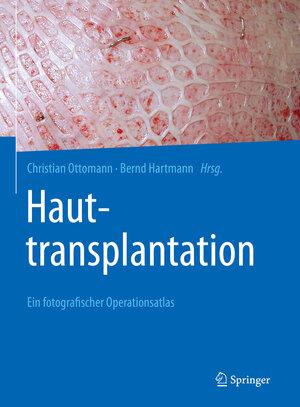 Buchcover Hauttransplantation  | EAN 9783662620595 | ISBN 3-662-62059-6 | ISBN 978-3-662-62059-5