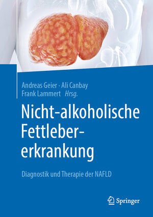 Buchcover Nicht-alkoholische Fettlebererkrankung  | EAN 9783662624838 | ISBN 3-662-62483-4 | ISBN 978-3-662-62483-8