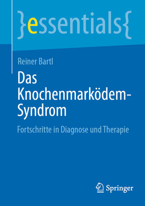 Buchcover Das Knochenmarködem-Syndrom | Reiner Bartl | EAN 9783662690147 | ISBN 3-662-69014-4 | ISBN 978-3-662-69014-7