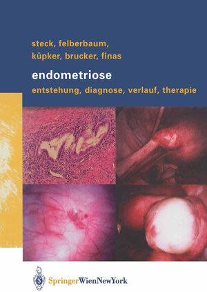 Buchcover Endometriose | Thomas Steck | EAN 9783709105740 | ISBN 3-7091-0574-9 | ISBN 978-3-7091-0574-0