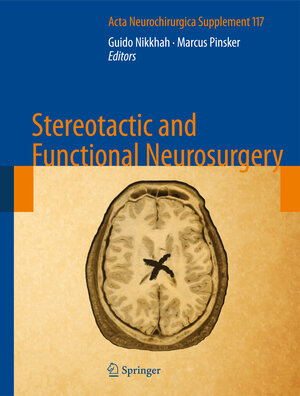 Buchcover Stereotactic and Functional Neurosurgery  | EAN 9783709114810 | ISBN 3-7091-1481-0 | ISBN 978-3-7091-1481-0