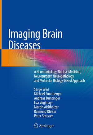 Buchcover Imaging Brain Diseases | Serge Weis | EAN 9783709115435 | ISBN 3-7091-1543-4 | ISBN 978-3-7091-1543-5