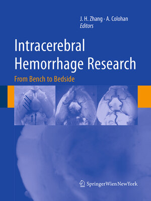 Buchcover Intracerebral Hemorrhage Research  | EAN 9783709120071 | ISBN 3-7091-2007-1 | ISBN 978-3-7091-2007-1