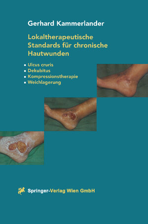 Buchcover Lokaltherapeutische Standards für chronische Hautwunden | Gerhard Kammerlander | EAN 9783709144237 | ISBN 3-7091-4423-X | ISBN 978-3-7091-4423-7
