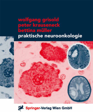Buchcover Praktische Neuroonkologie | Wolfgang Grisold | EAN 9783709163146 | ISBN 3-7091-6314-5 | ISBN 978-3-7091-6314-6