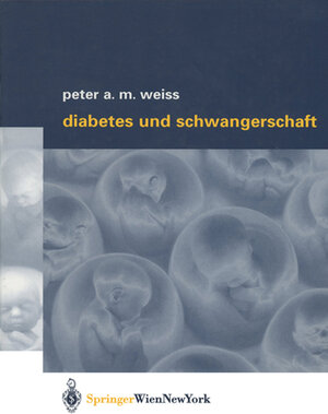 Buchcover Diabetes und Schwangerschaft | Peter A.M. Weiss | EAN 9783709167359 | ISBN 3-7091-6735-3 | ISBN 978-3-7091-6735-9