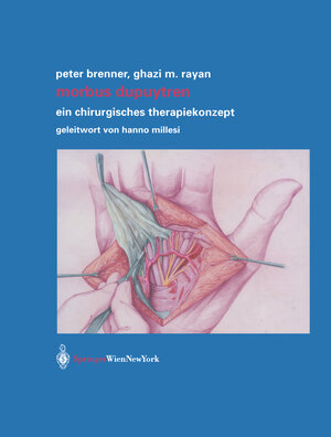 Buchcover Morbus Dupuytren | Peter Brenner | EAN 9783709173923 | ISBN 3-7091-7392-2 | ISBN 978-3-7091-7392-3