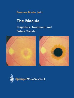 Buchcover The Macula  | EAN 9783709179871 | ISBN 3-7091-7987-4 | ISBN 978-3-7091-7987-1