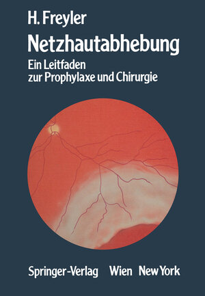 Buchcover Netzhautabhebung | Heinrich Freyler | EAN 9783709186749 | ISBN 3-7091-8674-9 | ISBN 978-3-7091-8674-9