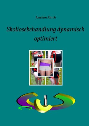 Buchcover Skoliosebehandlung dynamisch optimiert | Joachim Karch | EAN 9783734762918 | ISBN 3-7347-6291-X | ISBN 978-3-7347-6291-8