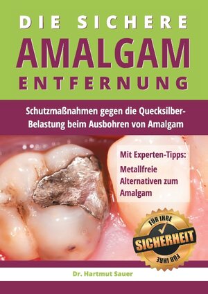 Buchcover Die sichere Amalgam-Entfernung | Hartmut Sauer | EAN 9783735763242 | ISBN 3-7357-6324-3 | ISBN 978-3-7357-6324-2