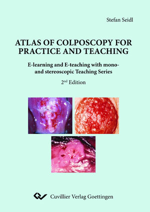 Buchcover Atlas of Colposcopy for Practice and Teaching | Stefan Seidl | EAN 9783736970304 | ISBN 3-7369-7030-7 | ISBN 978-3-7369-7030-4