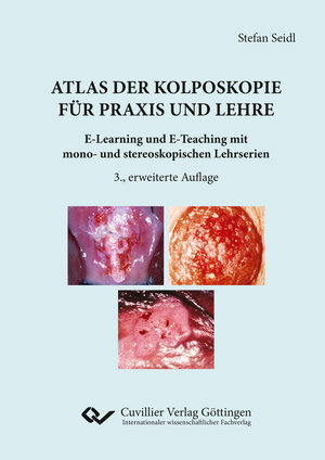 Buchcover Atlas der Kolposkopie für Praxis und Lehre | Stefan Seidl | EAN 9783736972186 | ISBN 3-7369-7218-0 | ISBN 978-3-7369-7218-6