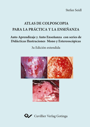 Buchcover Atlas de colposcopia para la práctica y la enseñanza | Stefan Seidl | EAN 9783736973169 | ISBN 3-7369-7316-0 | ISBN 978-3-7369-7316-9