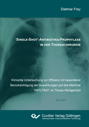 Buchcover 'Single-Shot'-Antibiotika-Prophylaxe in der Thoraxchirurgie | Dietmar Frey | EAN 9783736974074 | ISBN 3-7369-7407-8 | ISBN 978-3-7369-7407-4