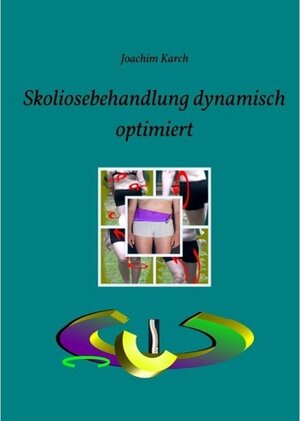 Buchcover Skoliosebehandlung dynamisch optimiert | Joachim Karch | EAN 9783738696448 | ISBN 3-7386-9644-X | ISBN 978-3-7386-9644-8