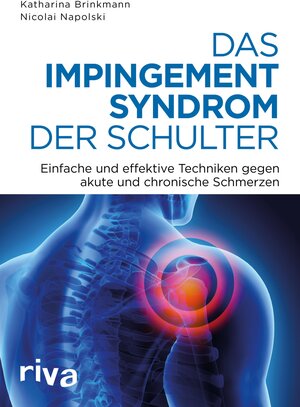 Buchcover Das Impingement-Syndrom der Schulter | Nicolai Napolski | EAN 9783745300338 | ISBN 3-7453-0033-5 | ISBN 978-3-7453-0033-8
