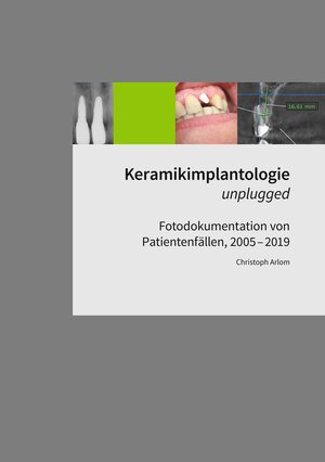 Buchcover Keramikimplantologie unplugged | Christoph Arlom | EAN 9783749478675 | ISBN 3-7494-7867-8 | ISBN 978-3-7494-7867-5