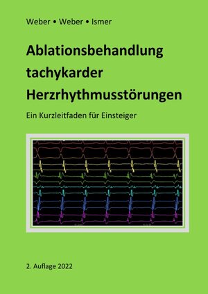 Buchcover Ablationsbehandlung tachykarder Herzrhythmusstörungen | Frank Weber | EAN 9783756539673 | ISBN 3-7565-3967-9 | ISBN 978-3-7565-3967-3