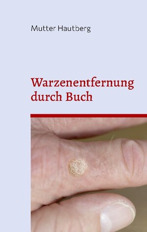 Buchcover Warzenentfernung durch Buch | Mutter Hautberg | EAN 9783756835997 | ISBN 3-7568-3599-5 | ISBN 978-3-7568-3599-7