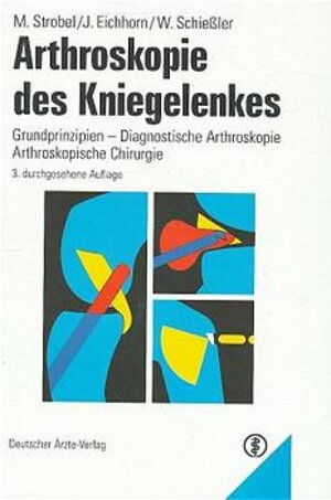 Arthroskopie des Kniegelenkes