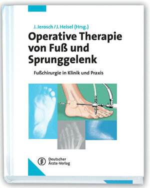Buchcover Operative Therapie von Fuß und Sprunggelenk  | EAN 9783769104882 | ISBN 3-7691-0488-9 | ISBN 978-3-7691-0488-2
