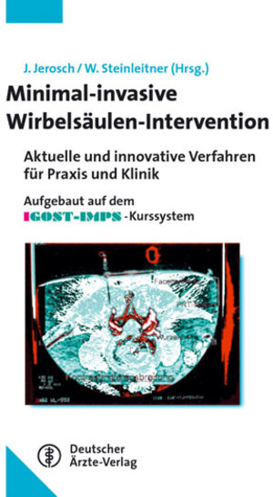 Buchcover Minimalinvasive Wirbelsäulen-Intervention  | EAN 9783769104899 | ISBN 3-7691-0489-7 | ISBN 978-3-7691-0489-9