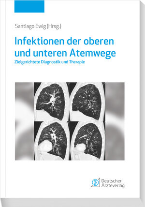 Buchcover Infektionen der oberen und unteren Atemwege  | EAN 9783769137682 | ISBN 3-7691-3768-X | ISBN 978-3-7691-3768-2