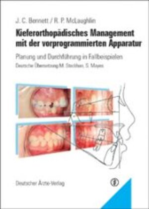 Kieferorthopädisches Management mit der vorprogrammierten Apparatur. Planung und Durchführung in Fallbeispielen