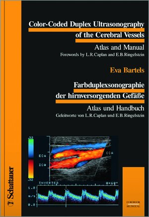 Buchcover Color-Coded Duplex Ultrasonography of the Cerebral Vessels. Farbduplexsonographie der hirnversorgenden Gefässe | Eva Bartels | EAN 9783794517404 | ISBN 3-7945-1740-7 | ISBN 978-3-7945-1740-4