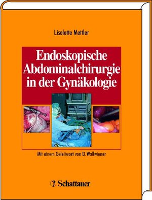 Endoskopische Abdominalchirurgie in der Gynäkologie