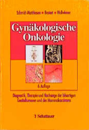 Gynäkologische Onkologie