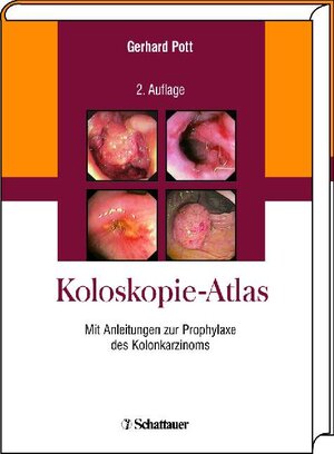 Koloskopie-Atlas. Mit Anleitungen zur Prophylaxe des Kolonkarzinoms