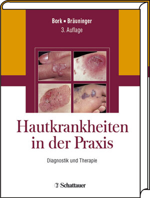 Buchcover Hautkrankheiten in der Praxis | Konrad Bork | EAN 9783794523214 | ISBN 3-7945-2321-0 | ISBN 978-3-7945-2321-4