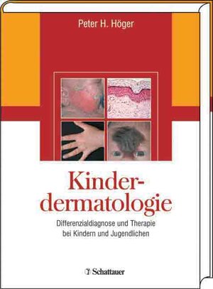 Buchcover Ödeme und Lymphdrainage | Ulrich Herpertz | EAN 9783794523535 | ISBN 3-7945-2353-9 | ISBN 978-3-7945-2353-5