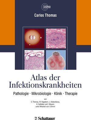 Buchcover Atlas der Infektionskrankheiten | Carlos Thomas | EAN 9783794527625 | ISBN 3-7945-2762-3 | ISBN 978-3-7945-2762-5