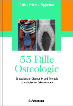 Buchcover 55 Fälle Osteologie  | EAN 9783794532209 | ISBN 3-7945-3220-1 | ISBN 978-3-7945-3220-9