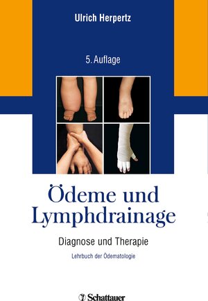 Buchcover Ödeme und Lymphdrainage | Ulrich Herpertz | EAN 9783794567430 | ISBN 3-7945-6743-9 | ISBN 978-3-7945-6743-0