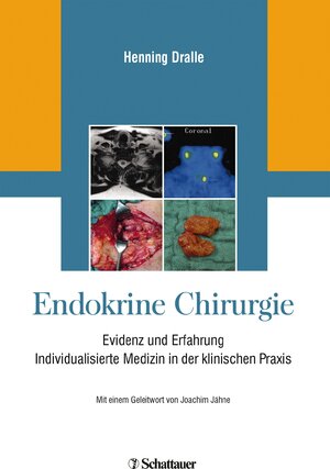 Buchcover Endokrine Chirurgie  | EAN 9783794567508 | ISBN 3-7945-6750-1 | ISBN 978-3-7945-6750-8