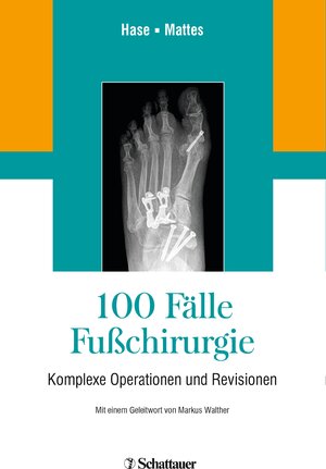 Buchcover 100 Fälle Fußchirurgie  | EAN 9783794568086 | ISBN 3-7945-6808-7 | ISBN 978-3-7945-6808-6