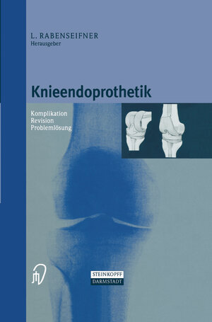 Buchcover Knieendoprothetik  | EAN 9783798511330 | ISBN 3-7985-1133-0 | ISBN 978-3-7985-1133-0