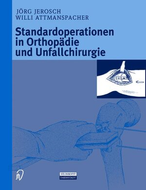 Buchcover Standardoperationen in Orthopädie und Unfallchirurgie | J. Jerosch | EAN 9783798511743 | ISBN 3-7985-1174-8 | ISBN 978-3-7985-1174-3