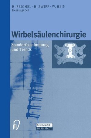 Buchcover Wirbelsäulenchirurgie  | EAN 9783798512252 | ISBN 3-7985-1225-6 | ISBN 978-3-7985-1225-2