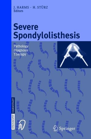 Buchcover Severe Spondylolisthesis  | EAN 9783798512535 | ISBN 3-7985-1253-1 | ISBN 978-3-7985-1253-5