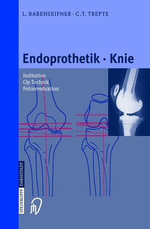Buchcover Endoprothetik Knie | L. Rabenseifner | EAN 9783798512689 | ISBN 3-7985-1268-X | ISBN 978-3-7985-1268-9