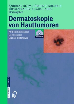 Dermatoskopie von Hauttumoren: Auflichtmikroskopie - Dermoskopie - Digitale Bildanalyse